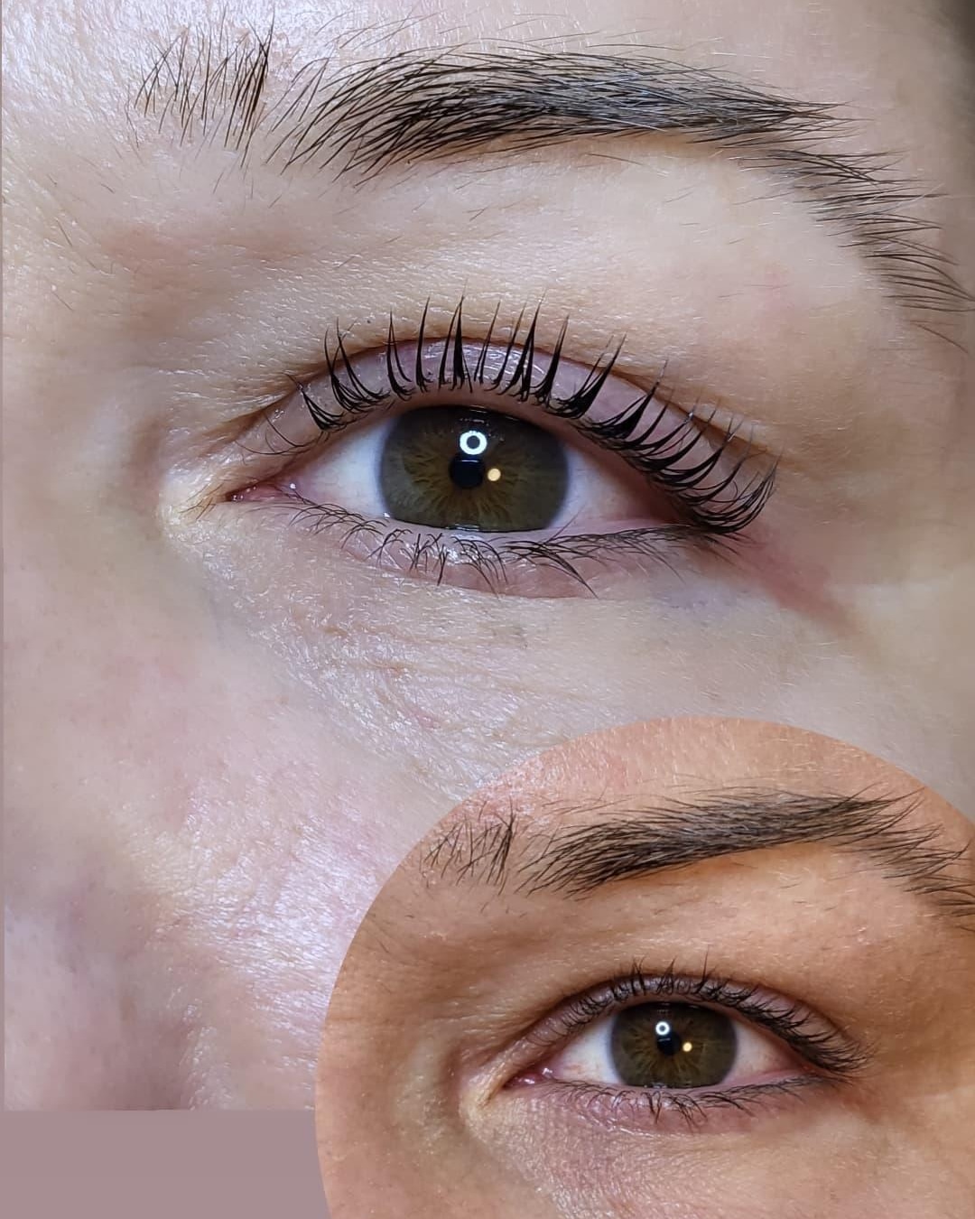 ALVA Beauty – Gesichtsbehandlung in Lübbecke
