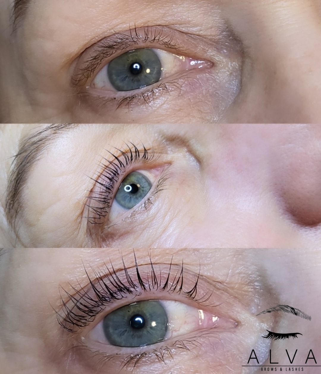 ALVA Beauty – Anti-Aging-Behandlung