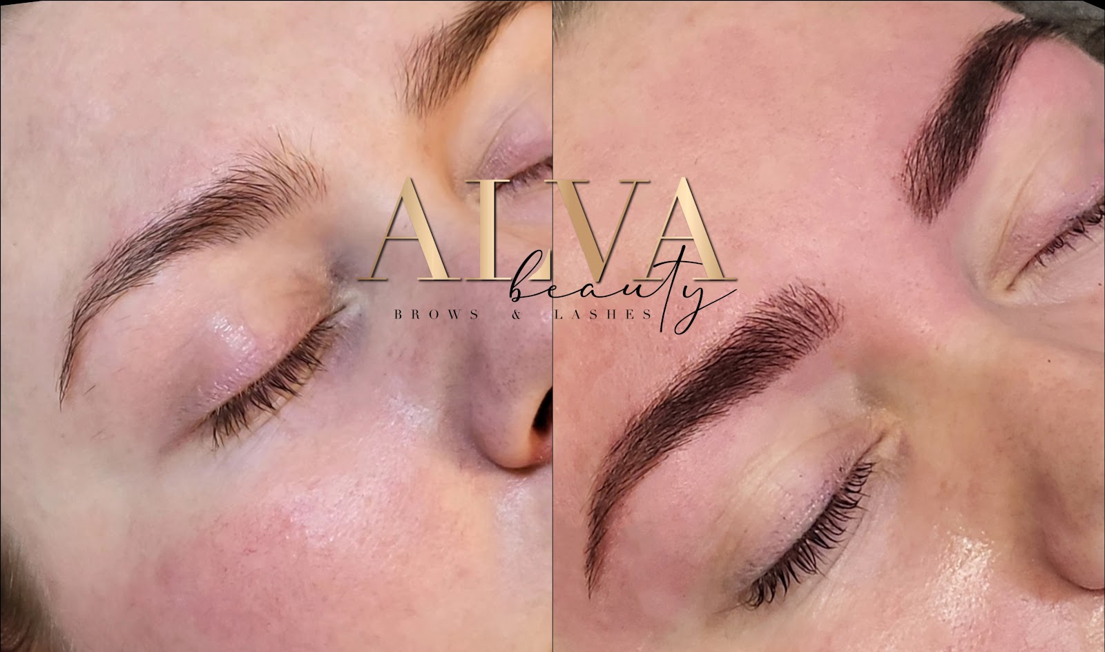 ALVA Beauty – Behandlungsdetail